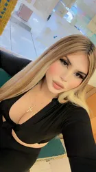 Escorts Modesto, California Visit  now🌹