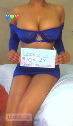 Escorts London, Ontario ★REAL & VERIFIED★♡SWEETEST TREAT